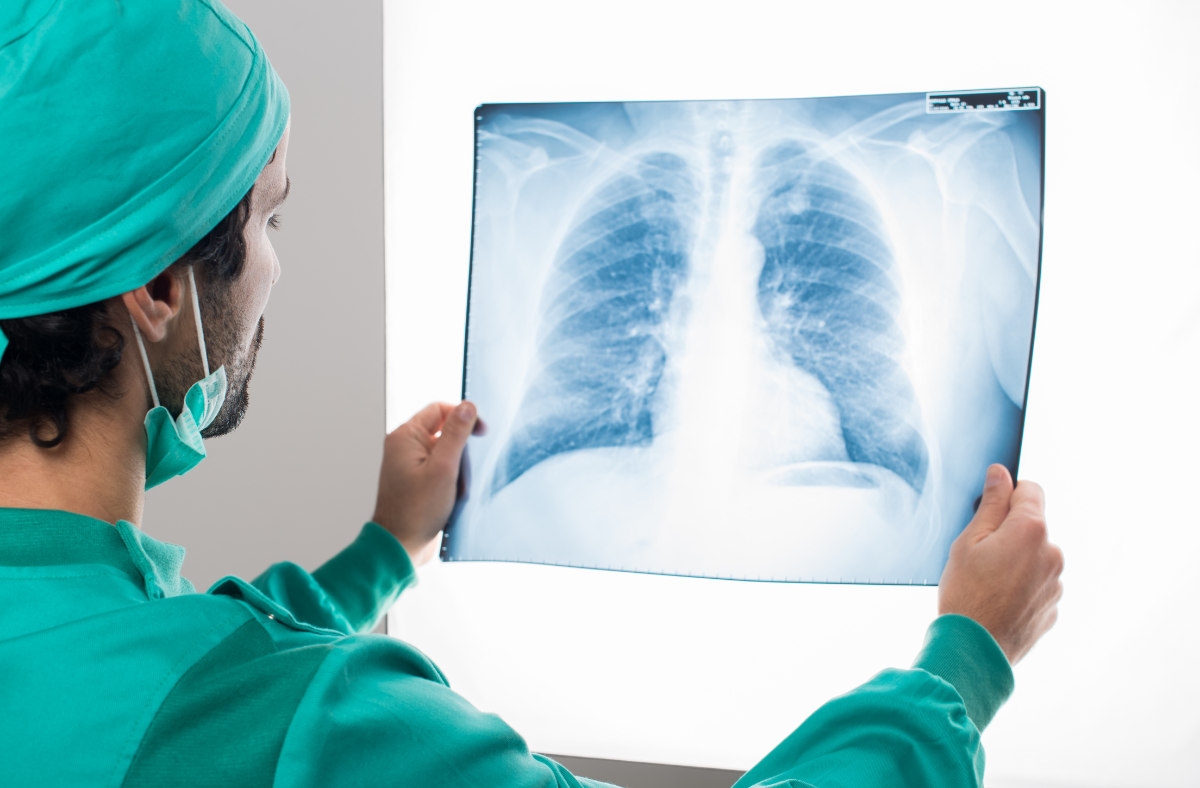 COPD, chronic obstructive pulmonary disease